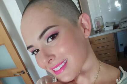 Natalia debió raparse luego del ataque