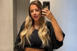 Nati Jota contó detalles de cómo fue su operación de la vista