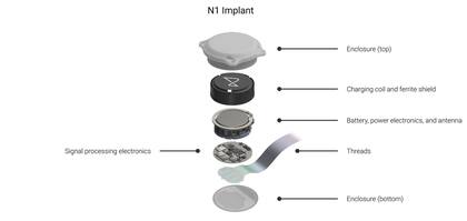 Neuralink dice que probó con éxito en un segundo voluntario su chip, que se inserta en el cerebro y permite controlar una computadora con la mente