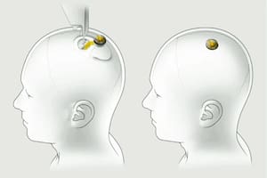 Cómo funciona Telepathy, el chip que permite hablarle a una computadora con el pensamiento