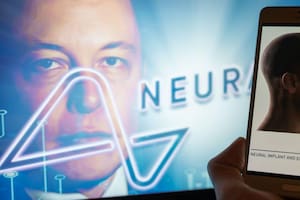 Elon Musk anuncia el primer implante de un chip de su compañía Neuralink en el cerebro de un humano