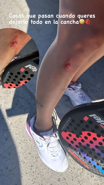 Nicole Neumann tuvo un incidente en un partido de pádel y mostró el resultado en las redes