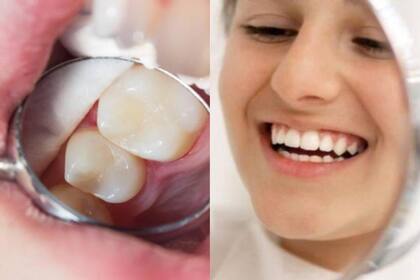 No hay que olvidarse de visitar un dentista regularmente para chequeos y limpiezas profesionales