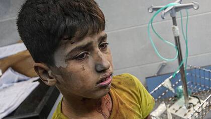 "No sé en qué momento de la historia de la humanidad defenderse significó matar de hambre y sed y desangrar a una población civil, en su mayoría niños", dice Mads Gilbert, médico noruego