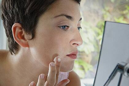 ¿Notaste manchas en tu piel?