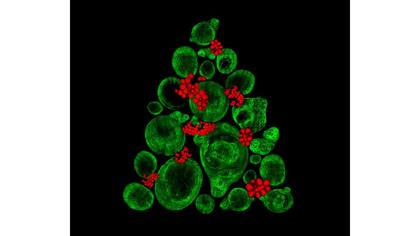 Noveno puesto del Nikon Small World 2017