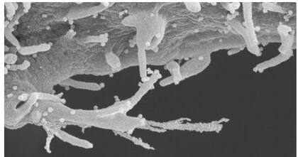 Nunca antes se había visto a la célula humana infectada por el coronavirus con este nivel de detalle