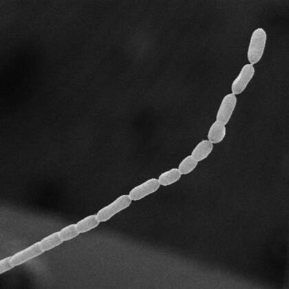 Observación por microscopía electrónica de barrido de Thiomargarita magnifica (Foto: biorxiv.org (Olivier Gros/Universidad de las Antillas vía AP)