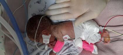 Olivia nació con 330 gramos