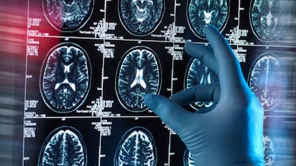 Olvidar una palabra está relacionado con cambios en la actividad en las regiones del cerebro que controlan los aspectos motores del habla