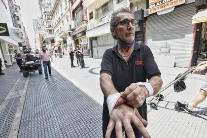 Omar muestra las heridas que le quedaron en las manos tras ayudar a unas quince personas a huir por el edificio vecino