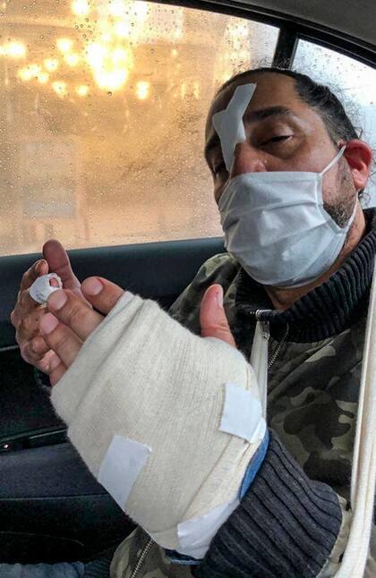 El comerciante, de 47 años, fue herido por el asaltante