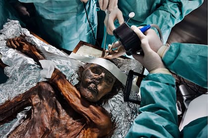 Ötzi es la momia más antigua preservada en hielo de la que se tiene conocimiento