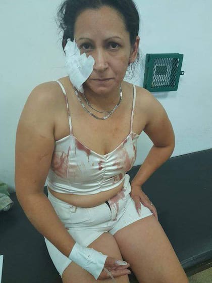 Pamela San Martin, victima de un intento de femicidio.