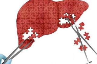 Cuáles son los cinco tipos de hepatitis: sus síntomas, cómo se transmite y cómo cuidar el hígado