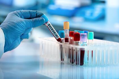 Para hacerse un test serológico hay que someterse a una extracción de sangre, seguida del análisis de la muestra en un laboratorio