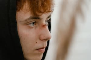 Para la cicatrización, la miel juega un rol fundamental (Foto Pexels)