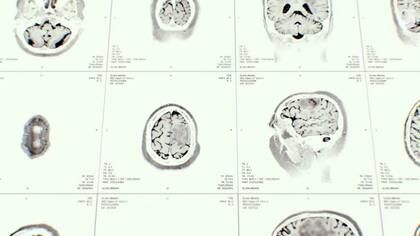 Para Leschziner es importante entender la salud física y mental como un todo