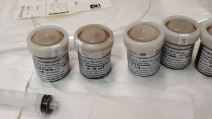 Para un trasplante fecal, se descongelan las heces, se filtran y se introducen en una jeringa