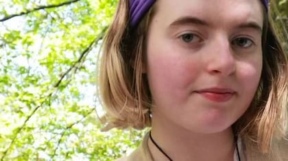 Paris también sufre tinnitus leve, una condición que está fuertemente relacionada con la nieve visual.