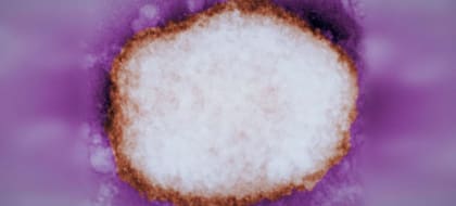 Partícula amplificada del virus de provoca la enfermedad; proponen investigar si alguna mutación profundizó la transmisión por contacto