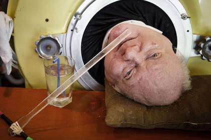 Paul Alexander, conocido como "Polio Paul", pasó las últimas siete décadas conectado a un artefacto que solía usarse antes del desarrollo de la vacuna contra la poliomielitis