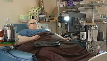 Paul llegó a comer 20.000 calorías al día, lo que en pocos años lo convirtió en el hombre más gordo del mundo