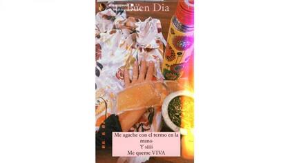 Paula Chaves mostró el resultado de
un doloroso accidente doméstico