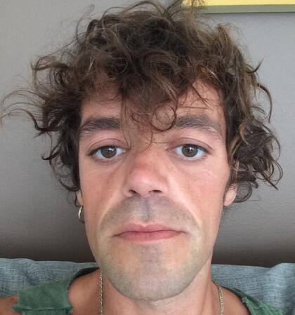 Payo tenía visa de turista por tres meses, pero por el corte y la infección no pudo volver antes del cierre de fronteras