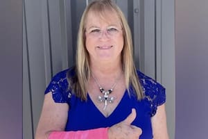 Peggy Jones, de 64 años, quedó con rasguños, cortes y hematomas tras el incidente