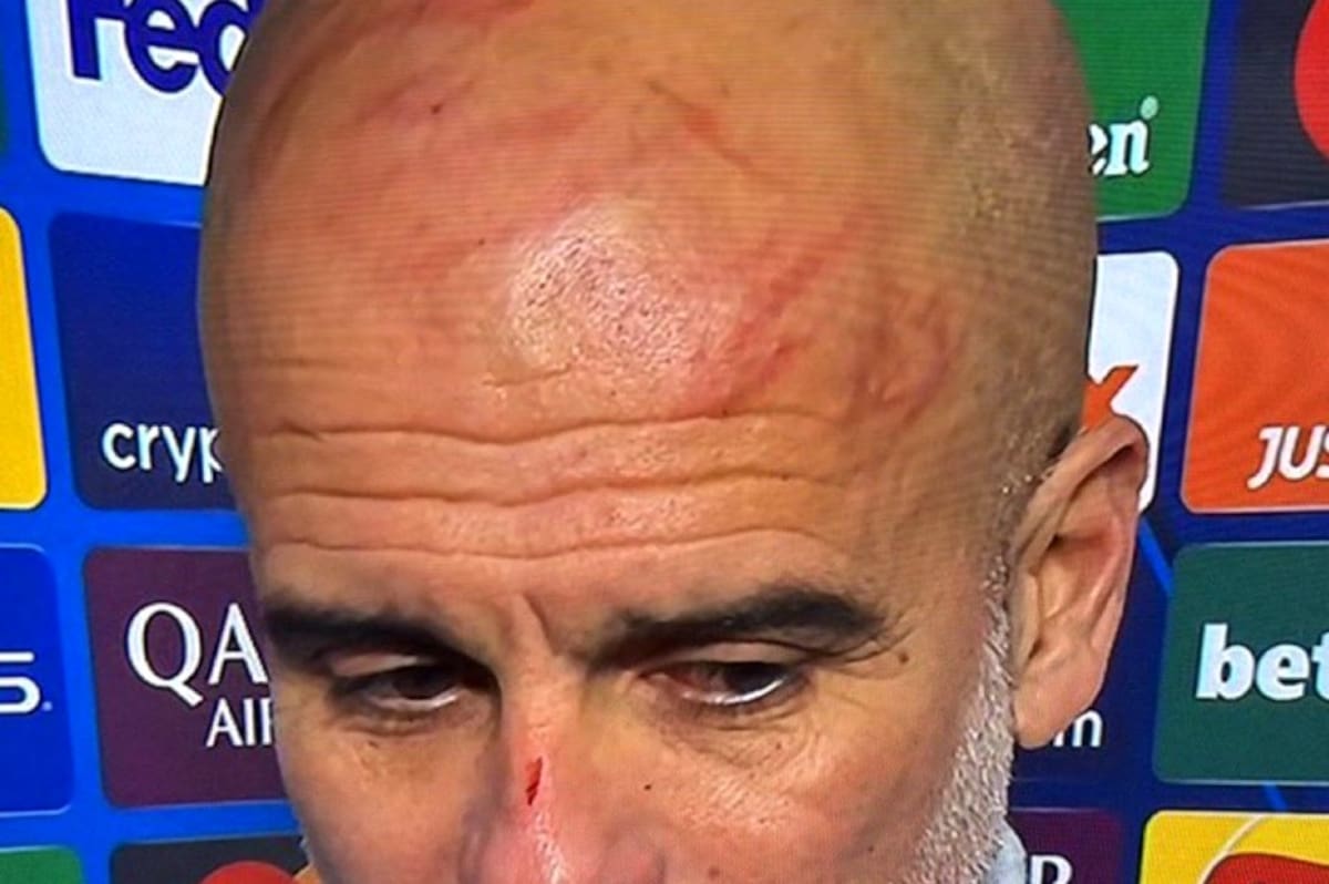 Video: Pep Guardiola se hizo daño a sí mismo tras la increíble remontada de Feyenoord ante Manchester City