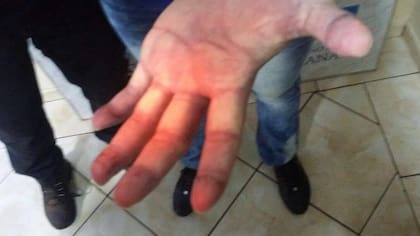 Pérez Corradi, detenido, fue objeto de pericias