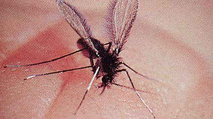 Picadura de dengue