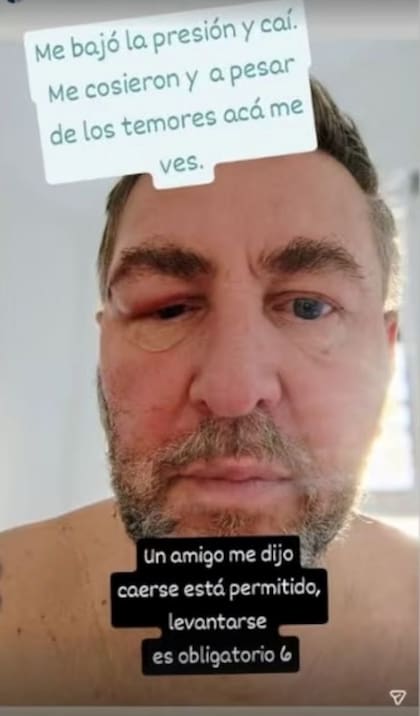 Pinsón habló sobre el accidente que sufrió en España