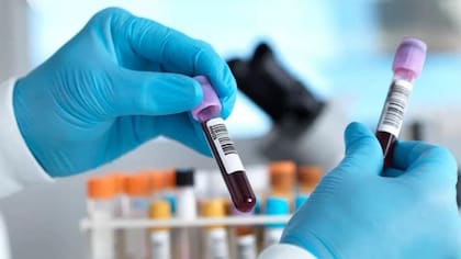 Pocos análisis médicos son 100% precisos