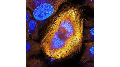 Primer puesto del Nikon Small World 2017