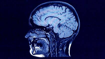 ¿Producimos nuevas neuronas en la vida adulta? El pico de la bomba ha ayudado a encontrar respuestas.