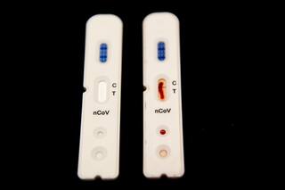 ¿Testeos diarios por coronavirus en casa? Los expertos tienen sus dudas