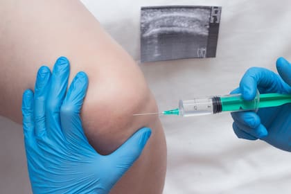 Puede administrarse en forma de infiltraciones, por vía endovenosa, rectal, vaginal, ótica, autovacuna, insuflaciones, entre otras