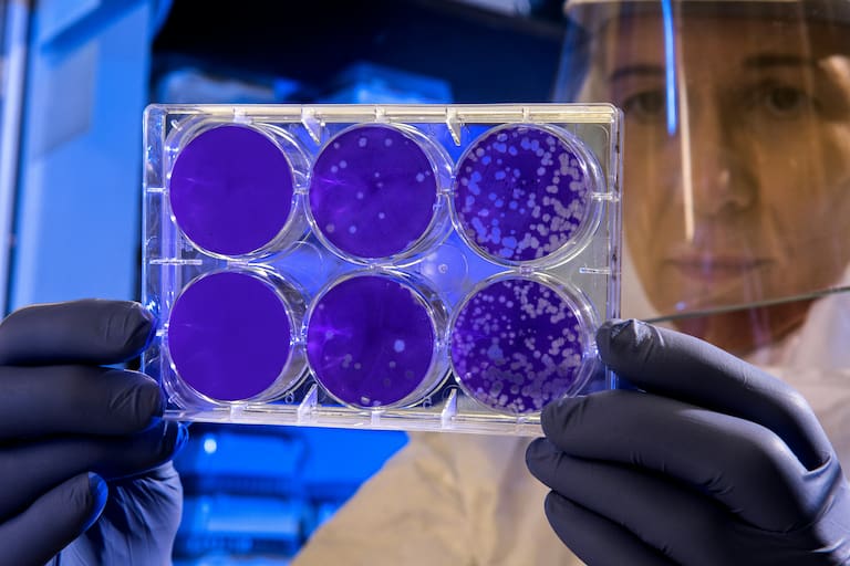 Qué es el “tercer estado” que sucede entre la vida y la muerte, según una investigación