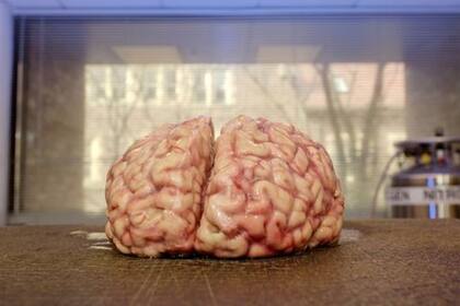 Este es un cerebro humano donado un centro de investigación de la Universidad de Harvard