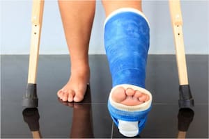 Las tres teorías sobre por qué hay personas que nunca se rompen un hueso