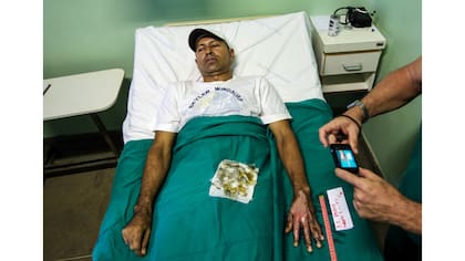 Una enfermera toma una fotografía de la piel quemada de un paciente que está siendo sometido a un tratamiento con piel tilapia en el Instituto Dr. José Frota en Fortaleza, Brasil