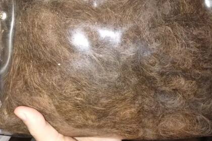 Rafael junto el cabello que se le cae (Foto gentileza Rafael para BBC)