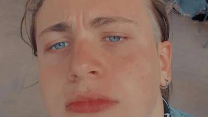 Recibió dos disparos cuando le intentaron robar la bicicleta