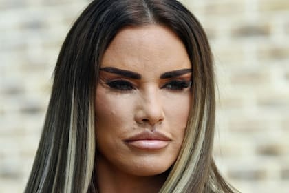 Recientemente, Katie Price mostró su rostro luego de recuperarse de las intervenciones