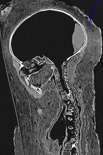 Reconstruyen el rostro de un niño egipcio momificado hace 2 mil años