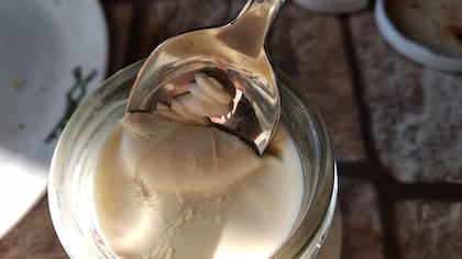 Refuerza el sistema inmunológico gracias a los probióticos y a nutrientes como el zinc y la vitamina D (Foto ilustrativa: PIXABAY)