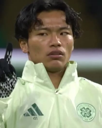 Reo Hatate sigue su dedo con los ojos para estimular al cerebro