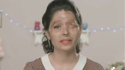 Reshma Qureshi, con su rostro desfigurado por un ataque con ácido